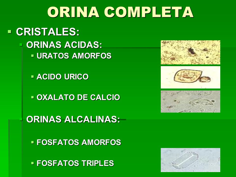 Cristales en orinas acidas y alcalinas